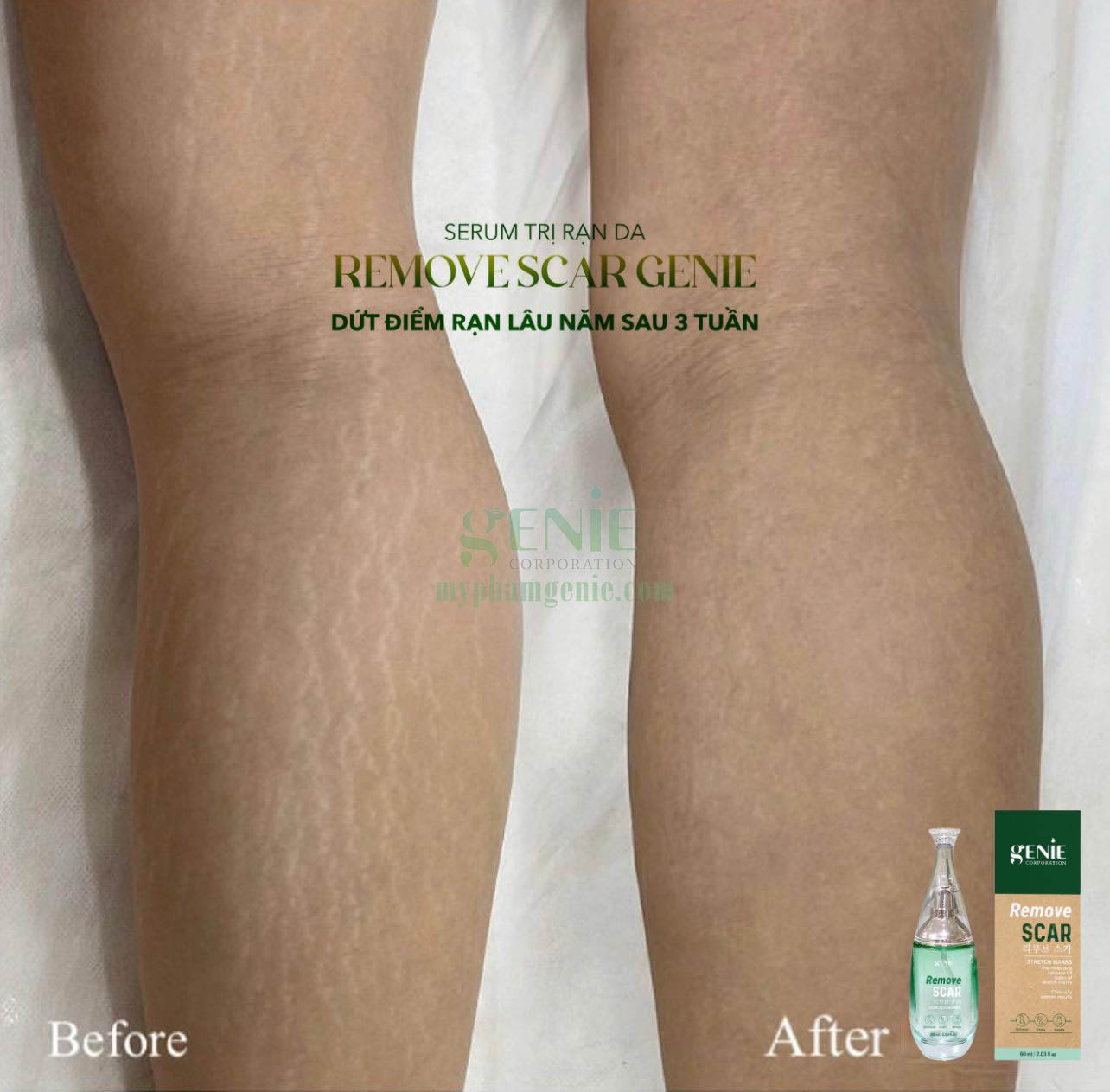 Serum trị thâm rạn nứt da 3 Serum trị thâm rạn nứt da